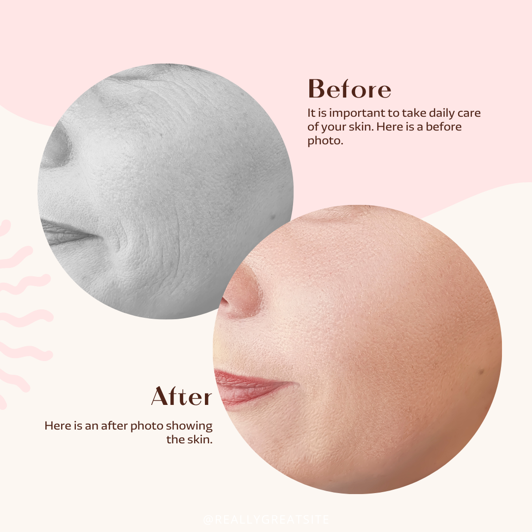 Face Roller