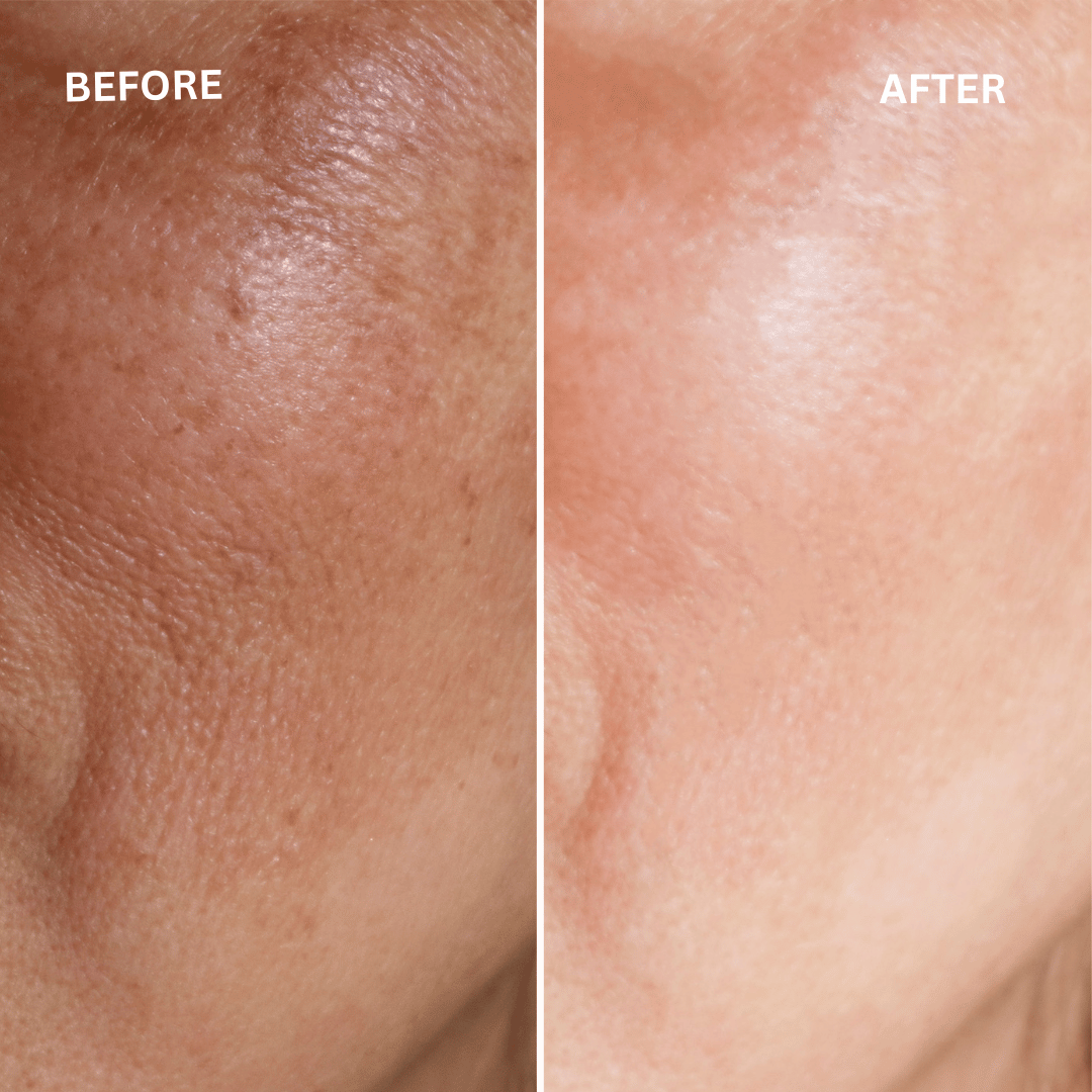Glycolic Acid Serum